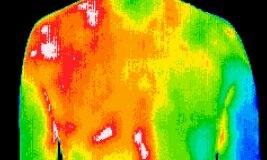 Colour-coded thermal image of the upper back and shoulders