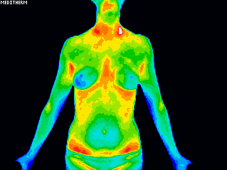 Colour-coded full-body thermogram viewed from the front